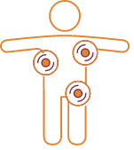 Illustrated icon showing cancer cells distributed throughout a human body, representing metastatic and distant prostate cancer.